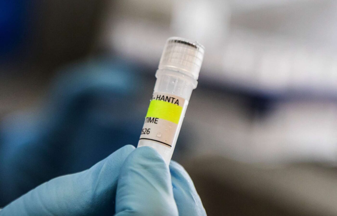 Tο ιταλικό υπουργείο υγείας ενεργοποίησε διαδικασία επιτήρησης για τέσσερις επιβάτες πτήσης που ήρθαν σε επαφή με γυναίκα η οποία πέθανε από Χανταϊό